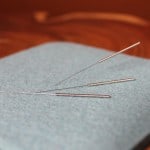 Blog Series Part 1: How Acupuncture Improves Fertility