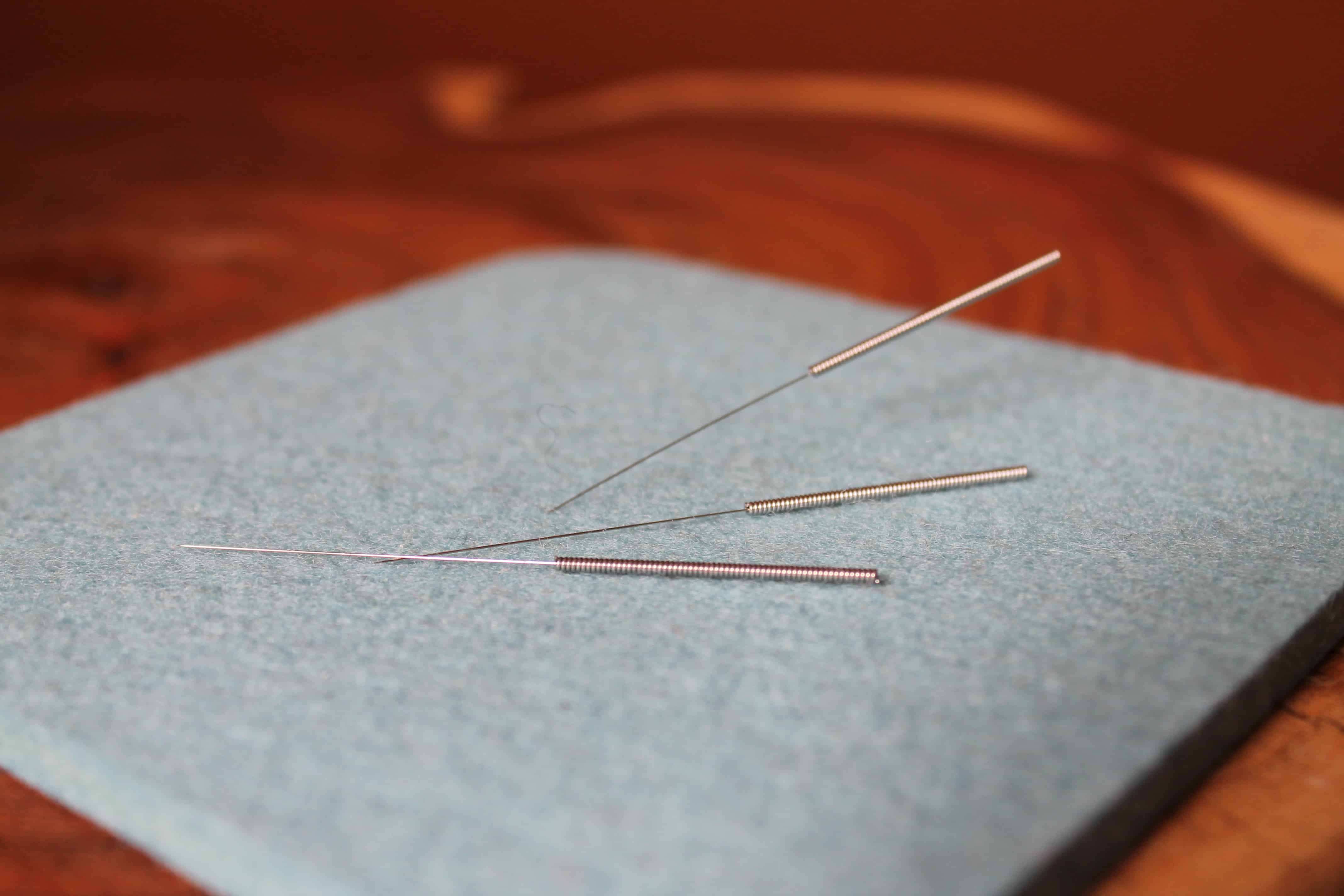 Blog Series Part 1: How Acupuncture Improves Fertility