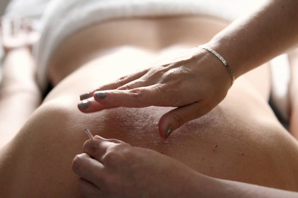 acupuncture-improves-fertility