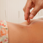 Where to Get Acupuncture Treatment for Infertility in Portland