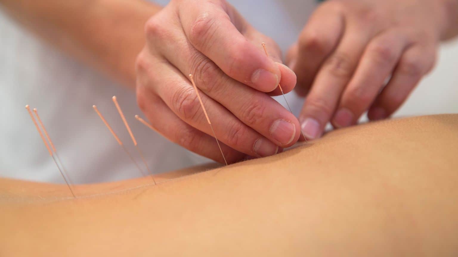 Acupuncture Portland Studio