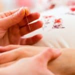 Acupuncture for Fertility: Acupuncture Naturally Boosts Fertility