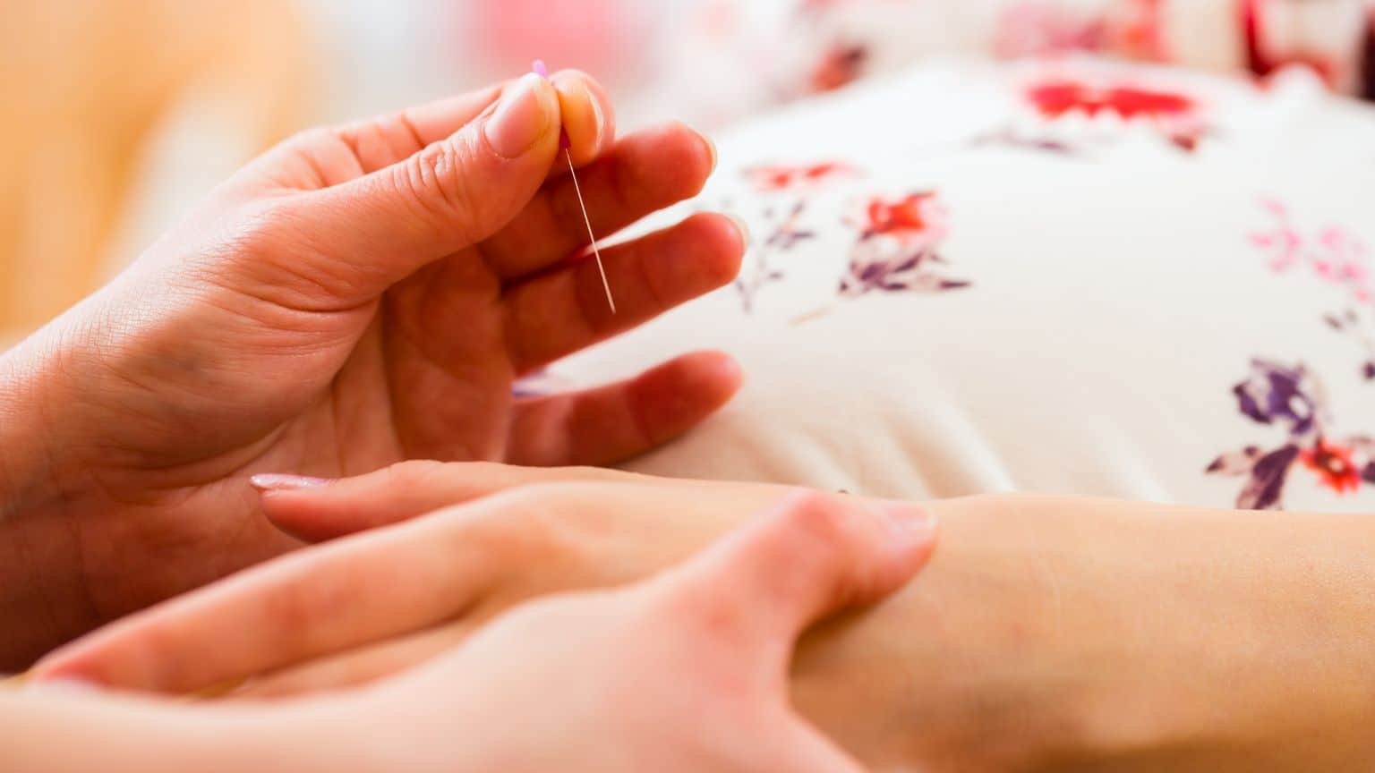 acupuncture for fertility