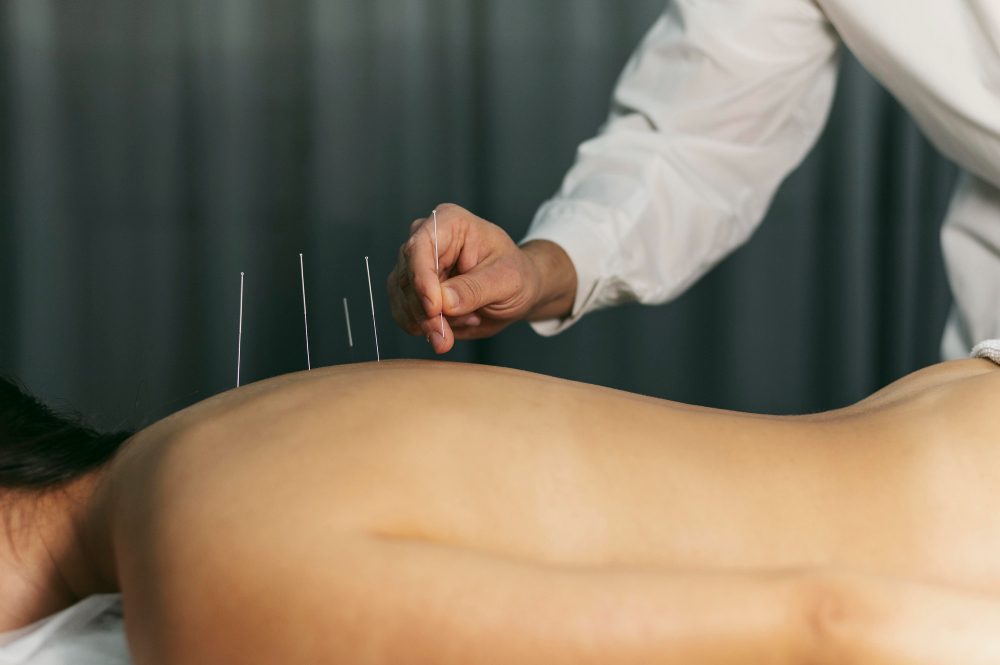 How effective is acupuncture for chronic back pain