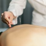 Acupuncture History 101: Everything You Need to Know About the Ancient Practice