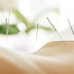 New Research Shows More Acupuncture is Better for FET Patients